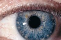 Irisdiagnose